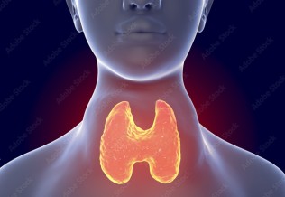 Hyperthyroïdie : diagnostic et traitement